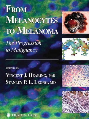 cover image of From Melanocytes to Melanoma